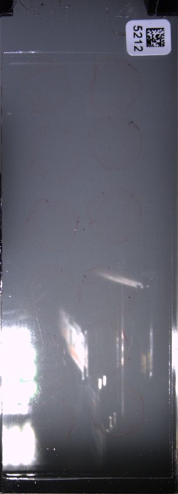 Media type: image; Special Collections 4011   shows specimen_part histological serial section;
